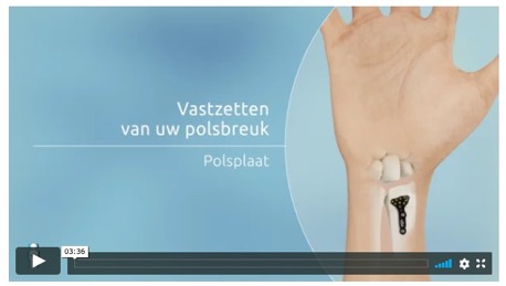 polsplaat video